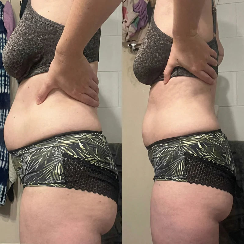 Draen customer photo 1 — individual experience, results not typical