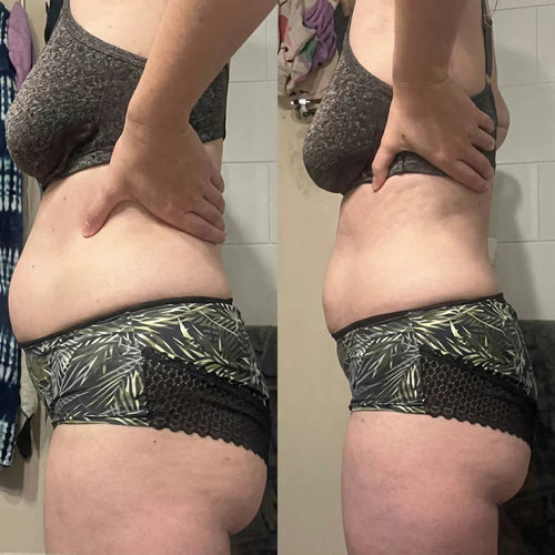 Draen customer photo 1 — individual experience, results not typical
