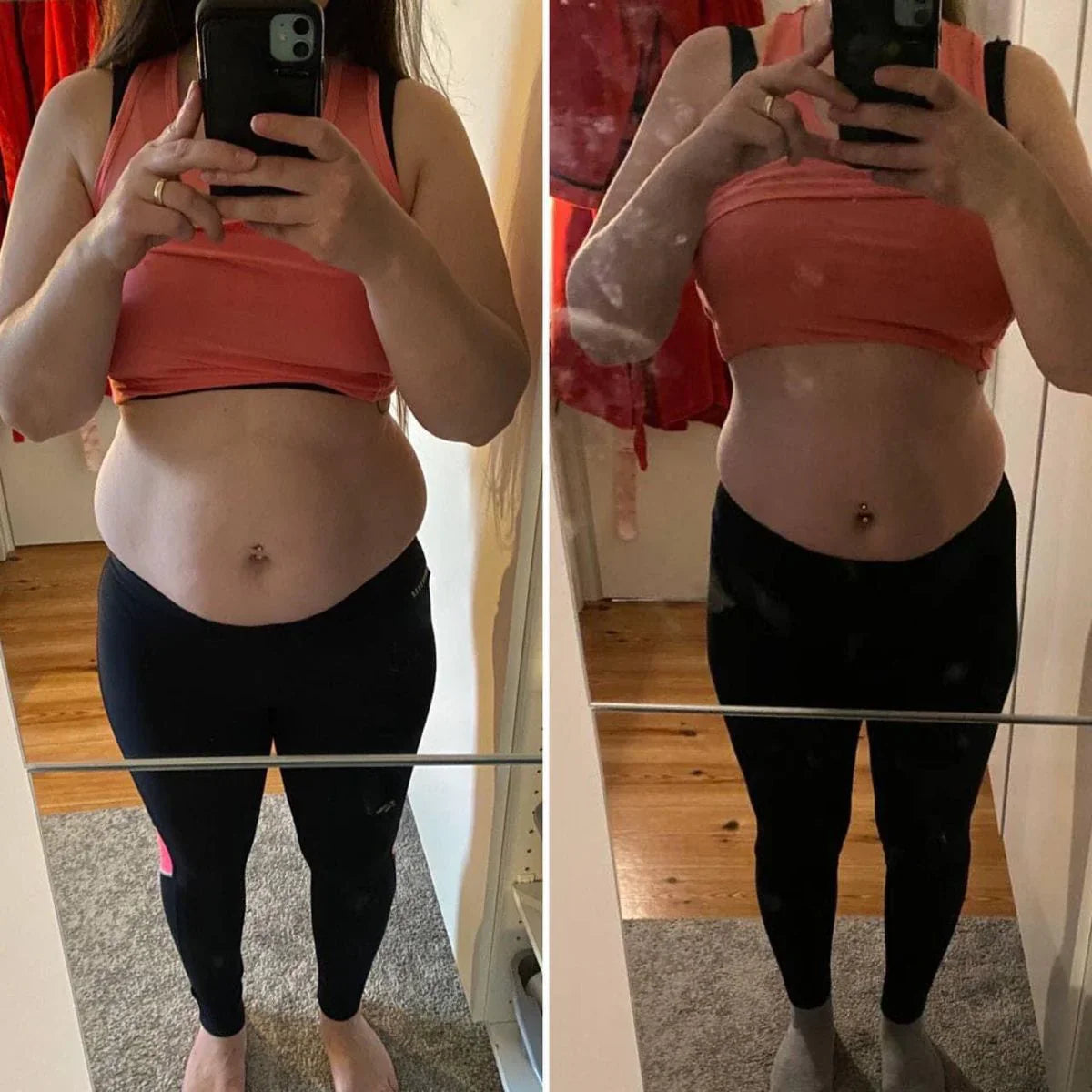 Draen before-after belly Image