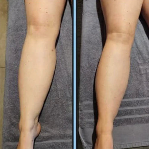 Draen before-after calves